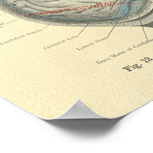  Bevroren Anatomische hersenen en schedel Poster (Hoek)