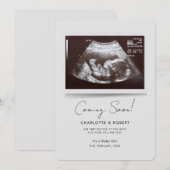 Binnenkort Baby Scan zwangerschap Aankondiging (Voorkant / Achterkant)