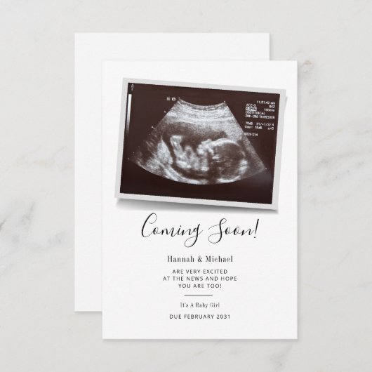 Binnenkort beschikbaar Manuscript Sonogram Aankond (Voorkant / Achterkant)