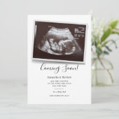 Binnenkort beschikbaar script Ultrasound Sonogram Aankondiging (Staand voorkant)