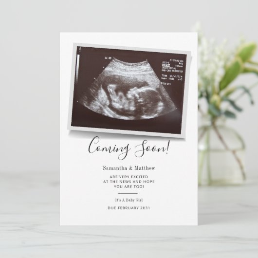 Binnenkort beschikbaar script Ultrasound Sonogram  Aankondiging (Staand voorkant)