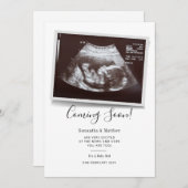 Binnenkort beschikbaar script Ultrasound Sonogram Aankondiging (Voorkant / Achterkant)