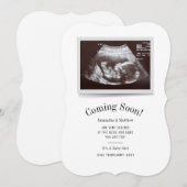 Binnenkort beschikbaar Ultrasound Foto's Kaart (Voorkant / Achterkant)