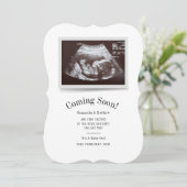 Binnenkort beschikbaar Ultrasound Foto's Kaart (Staand voorkant)