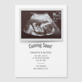 Binnenkort beschikbaar Ultrasound Foto's Zwangersc (Voorkant)