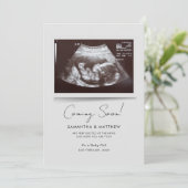 Binnenkort foto Baby Scan zwangerschap Aankondiging (Staand voorkant)