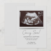 Binnenkort foto Baby Scan zwangerschap Aankondiging (Voorkant / Achterkant)