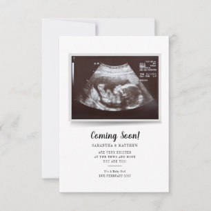 Binnenkort Script Ultrasound Foto Zwangerschap