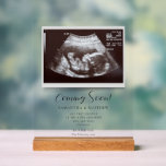 Binnenkort Sonogram zwangerschapsaankondiging Acryl Bord<br><div class="desc">Het is altijd een goed moment om dit spannende nieuws te delen met je naaste en dierbaarste. Pas dit aan door uw echografie te uploaden,  uw gegevens toe te voegen en deze onder de douche weer te geven.</div>