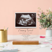 Binnenkort Sonogram zwangerschapsaankondiging Acryl Bord (Huwelijk)