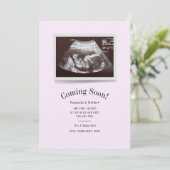 Binnenkort verkrijgbaar Ultrasound foto's Zwangers (Staand voorkant)