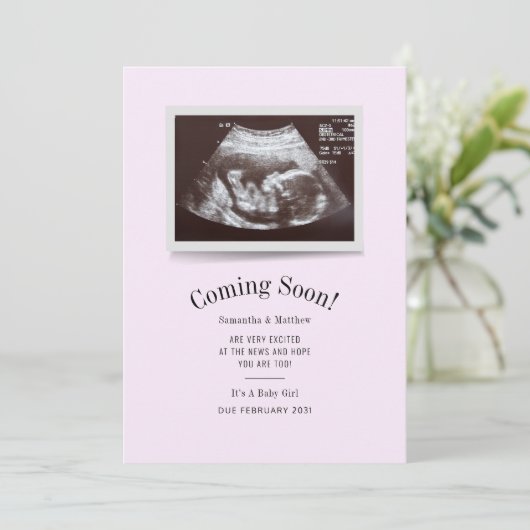 Binnenkort verkrijgbaar Ultrasound foto's Zwangers (Staand voorkant)