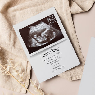 Binnenkort verkrijgbaar Ultrasound foto's Zwangers