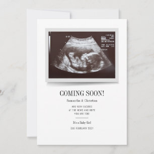 Binnenkort verkrijgbaar Ultrasound foto's Zwangers Kaart