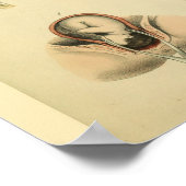 Birth Forceps Obstetrics Anatomic Medical Art Prin Poster (Hoek)