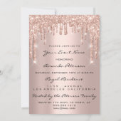 Birthday Party 16th Kiss Lips Roos Glitter Kaart (Achterkant)