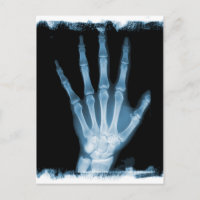 Blauwe röntgenplaat