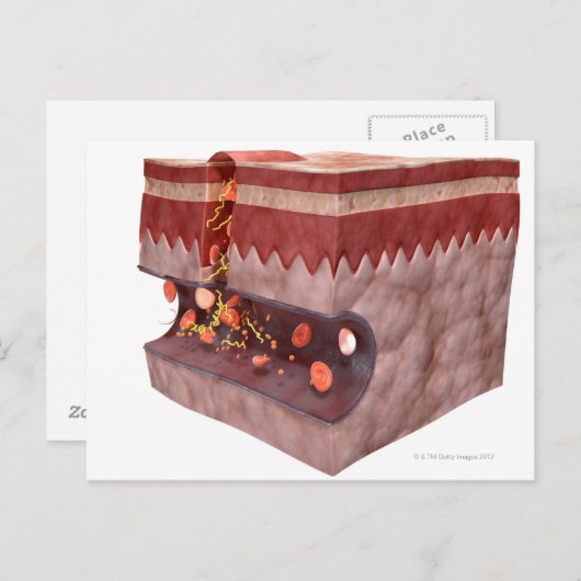 Bloedklokvorming Briefkaart (Voorkant / Achterkant)