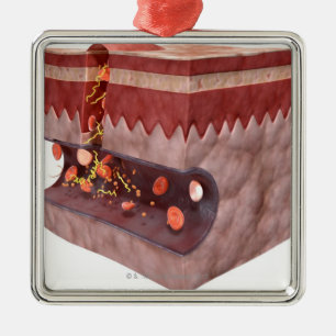 Bloedklokvorming Metalen Ornament