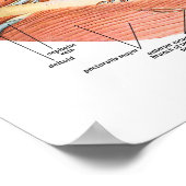 Bloedschepen van de nek poster (Hoek)