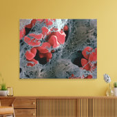 Bloedstolsel 2 canvas afdruk (Insitu (Woonkamer))