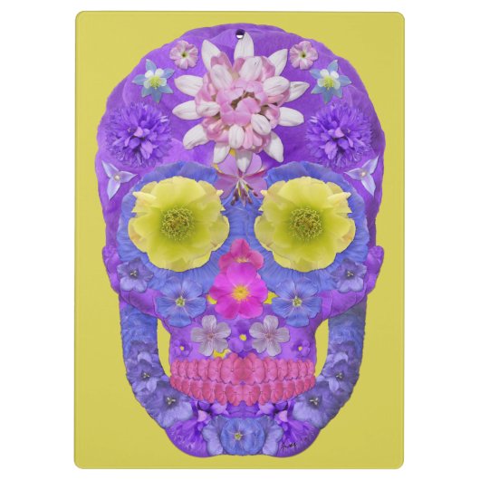 Bloedvatschedel 5 klembord (Achterkant)