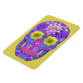 Bloedvatschedel 5 magneet (Linkerzijde)