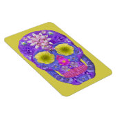 Bloedvatschedel 5 magneet (Rechterzijde)