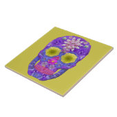 Bloedvatschedel 5 tegeltje (Zijkant)