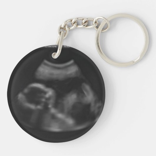 Blue Personalised Baby's Sonogram Verwacht papa Sleutelhanger (Achterkant)