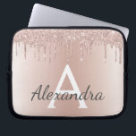 Blush Pink Rose Gold Metallic Glitter Monogram Laptop Sleeve<br><div class="desc">Blush roze roze gouden metalen druppelaar Glitter en Sparkle Modern en Elegant Monogram Hoesje. Dit hoesje kan worden aangepast om uw initiaal en voornaam op te nemen en maakt een geweldige kerst of 16 zoete cadeautjes voor 16e verjaardag.</div>