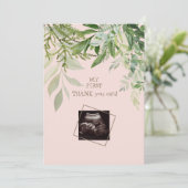 Blush Ultrasound Meisje Grappig Baby shower Dank u Bedankkaart (Staand voorkant)