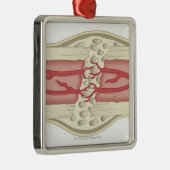 Bone die zichzelf herstelt 2 metalen ornament (Rechts)