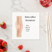 Bony-callus-vorming Servet (Insitu)