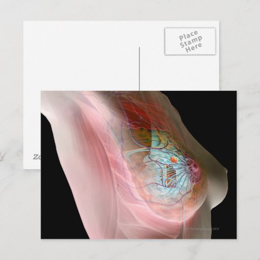 Borstkanker Briefkaart (Voorkant / Achterkant)