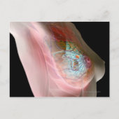 Borstkanker Briefkaart (Voorkant)