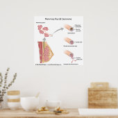 Borstkanker ductaal carcinoom, met een schema. poster (Keuken)