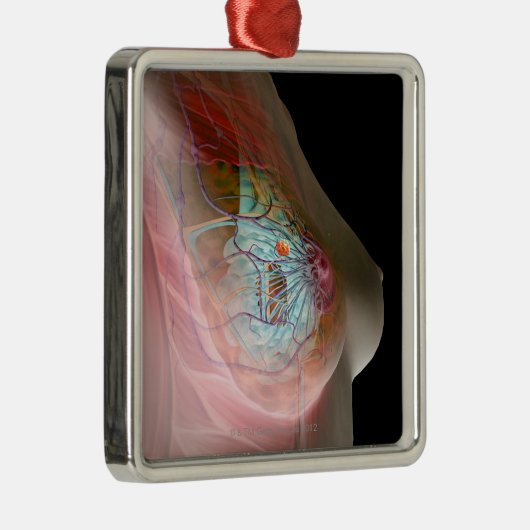 Borstkanker Metalen Ornament (Rechts)