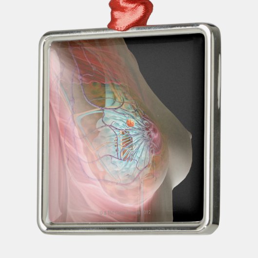 Borstkanker Metalen Ornament (Links)