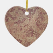 Borstkanker onder de microscoop keramisch ornament (Voorkant)