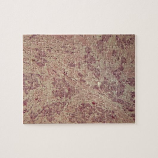 Borstkanker onder de microscoop legpuzzel (Horizontaal)