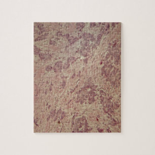Borstkanker onder de microscoop legpuzzel