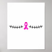 Borstkankeroverlevende met mastectomielitteken poster (Voorkant)