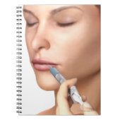 Botox injecties notitieboek (Voorkant)