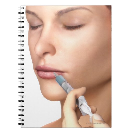 Botox injecties notitieboek (Voorkant)