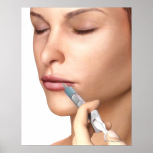 Botox injecties poster