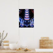 Botten onderaan achteraan 5 poster (Keuken)