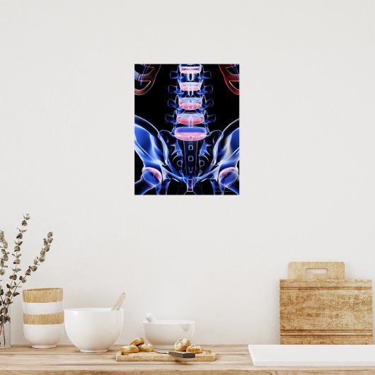 Botten onderaan achteraan 5 poster (Keuken)