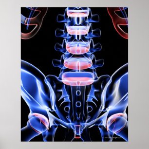 Botten onderaan achteraan 5 poster