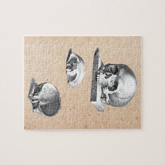 Botten orthopedische tekening legpuzzel (Horizontaal)